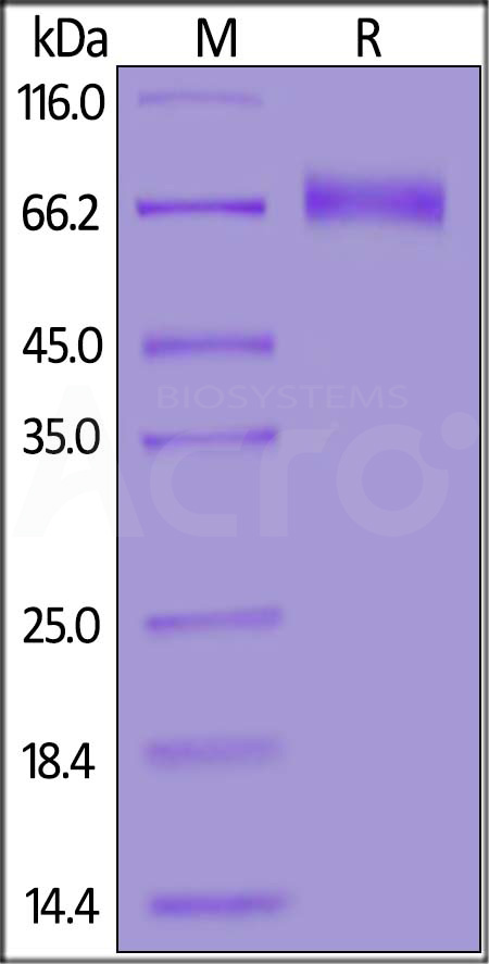 NKG2C & CD94 SDS-PAGE