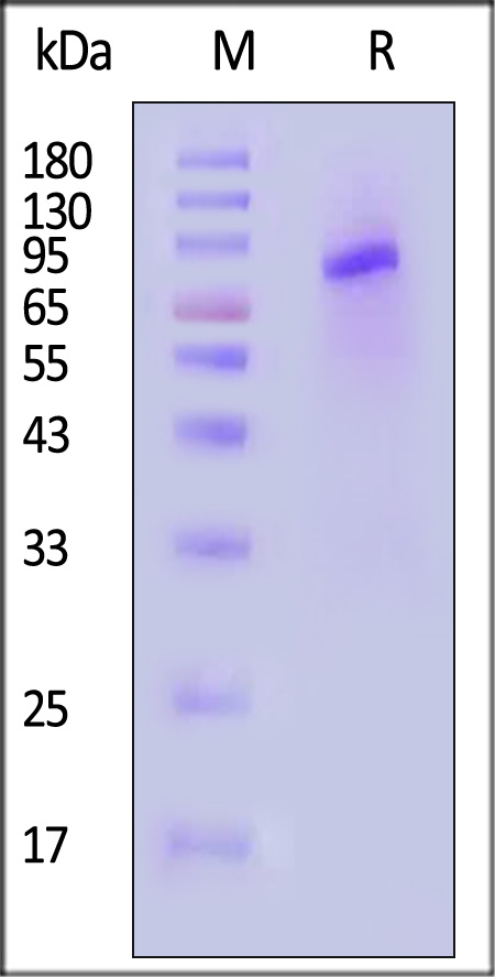 Neuraminidase/NA (Influenza Virus) SDS-PAGE