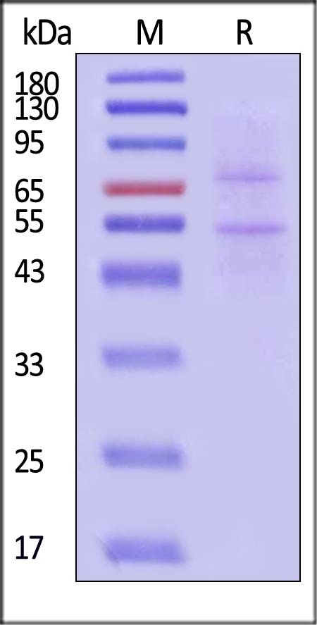 NK2R SDS-PAGE