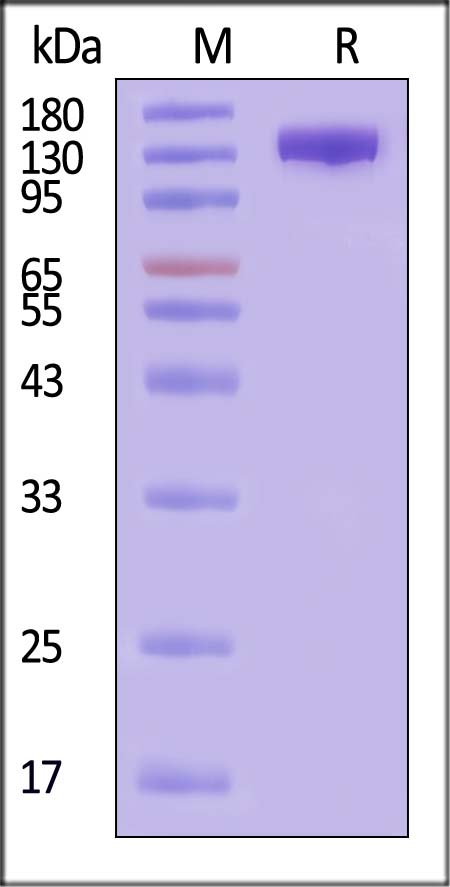 OSMR SDS-PAGE