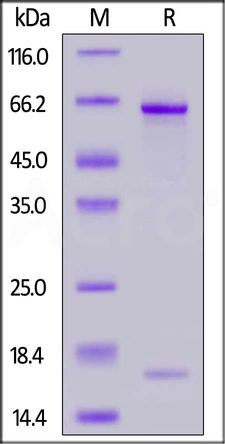 PCSK9 SDS-PAGE