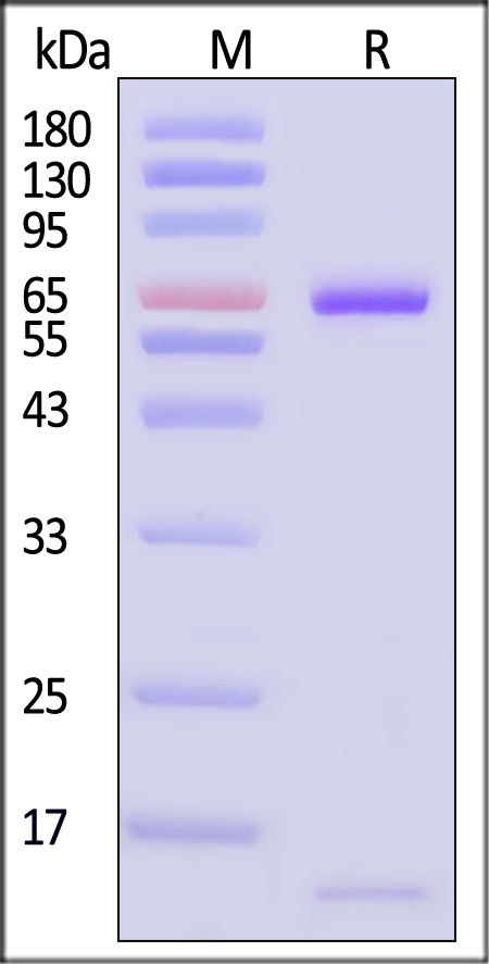PCSK9 SDS-PAGE