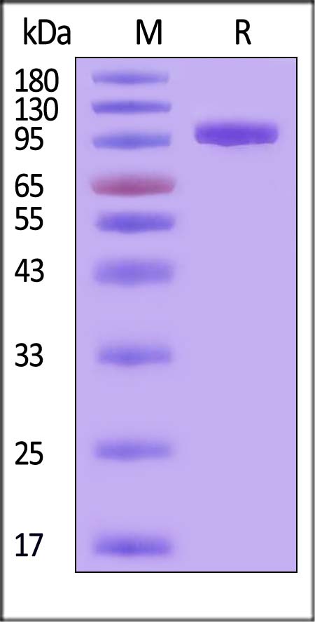 Rat PSMA / FOLH1 Protein, His Tag (active enzyme, MALS verified