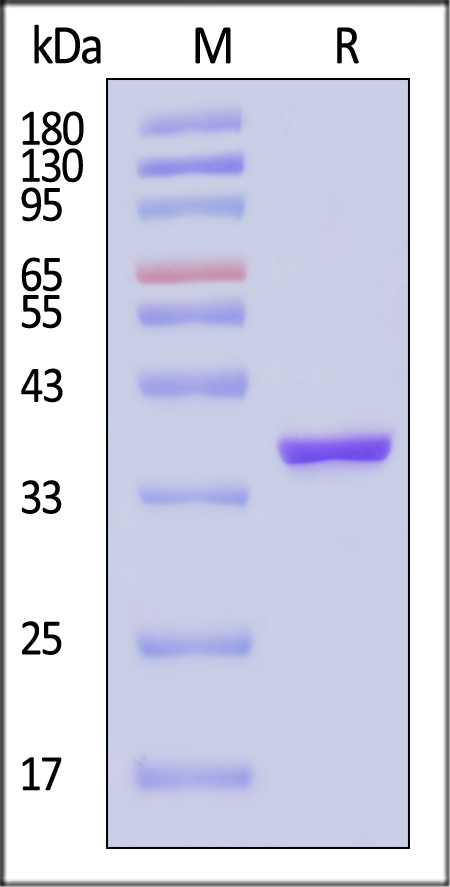 Human PTP1B Protein, His Tag (active enzyme, MALS verified)
