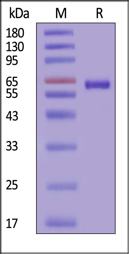 RIPK2 SDS-PAGE