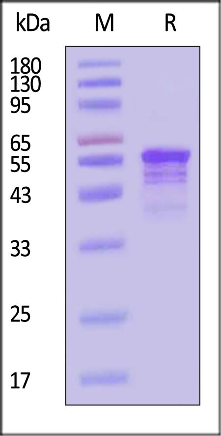 Tau SDS-PAGE