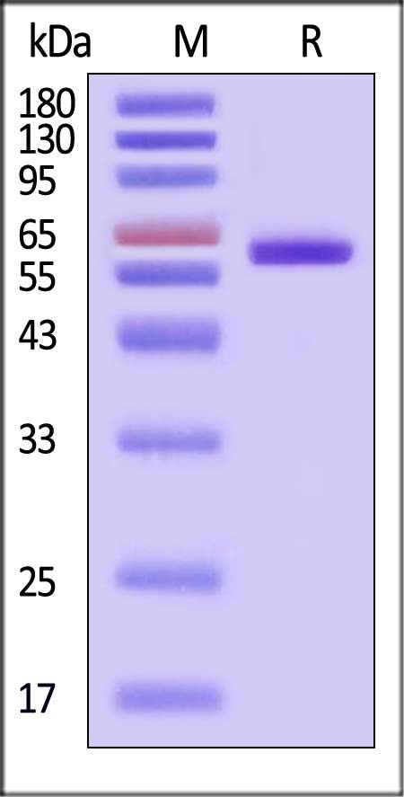 Tau SDS-PAGE