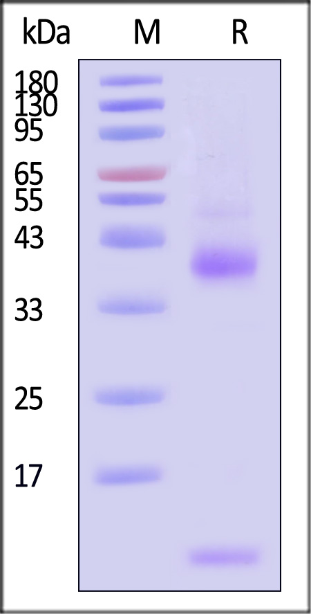 Latent TGF-beta 1 SDS-PAGE
