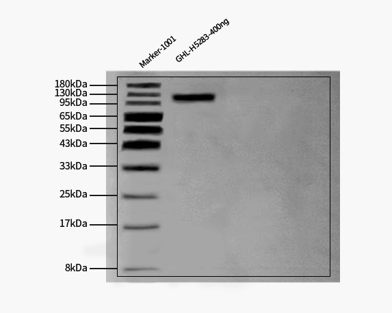 Glycoprotein H & Glycoprotein L/gH & gL (HSV) WESTERN BLOT