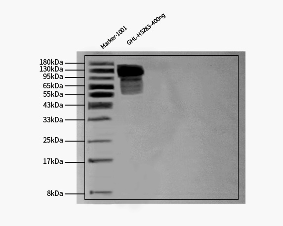 Glycoprotein H & Glycoprotein L/gH & gL (HSV) WESTERN BLOT