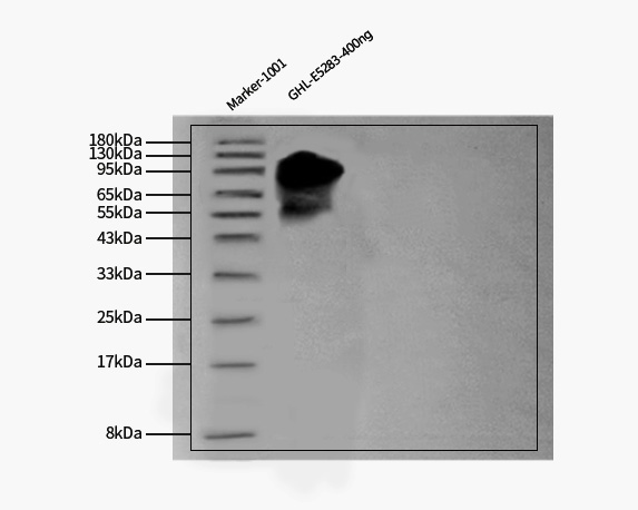 Glycoprotein H & Glycoprotein L/gH & gL (EBV) WESTERN BLOT
