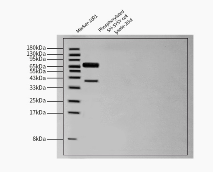 Tau WESTERN BLOT