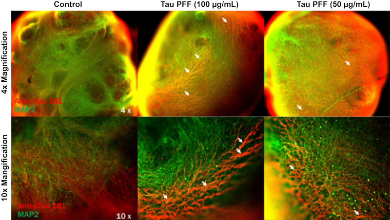 Tau PFFs induce Tau aggregation in brain organoids
