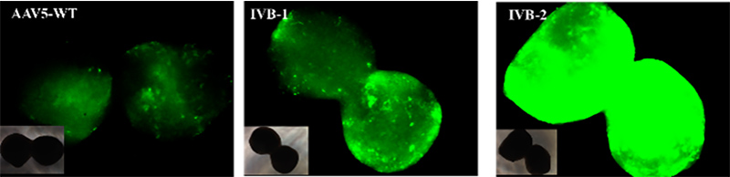 GFP fluorescence expression in brain organoids transduced with different AAV serotypes