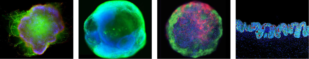 Liver Organoids