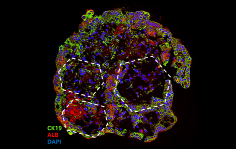 Liver Organoids