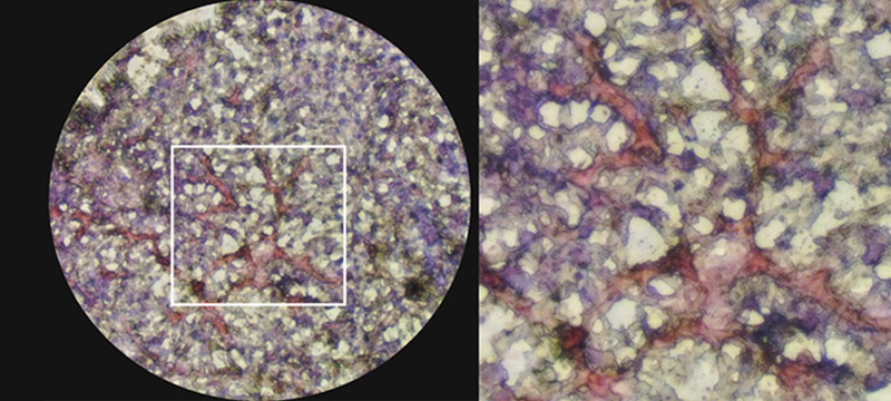 Liver Organoids