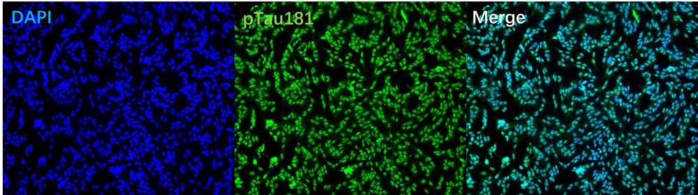 Brain Organoids and Tau PFFs