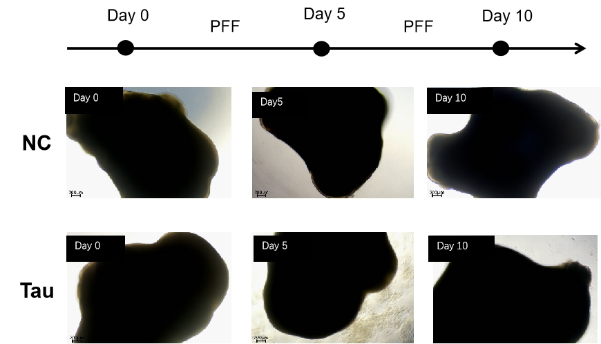 Brain Organoids and Tau PFFs