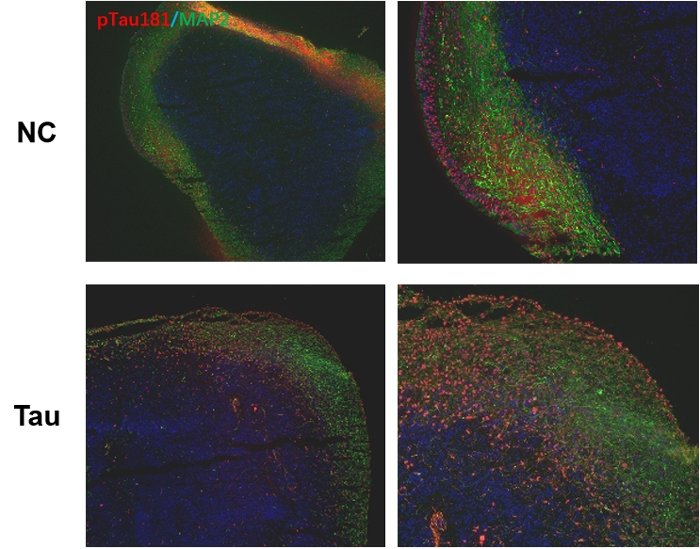 Brain Organoids and Tau PFFs