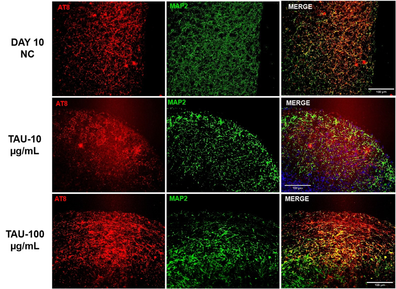 Brain Organoids and Tau PFFs
