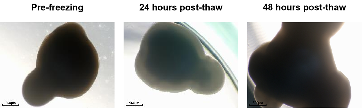Brain Organoids and Tau PFFs