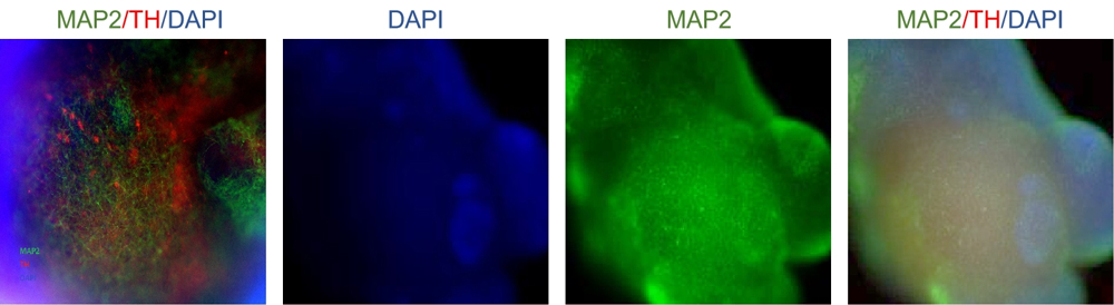 Brain Organoids and Tau PFFs