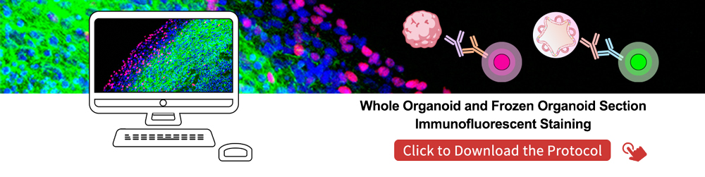 Brain Organoids and Tau PFFs