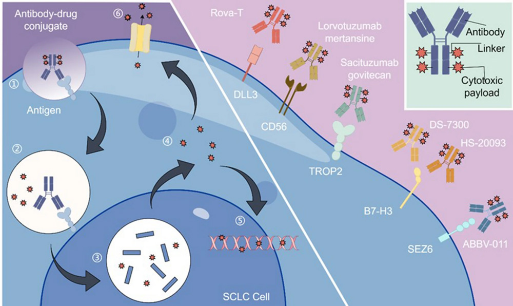 New Hope for SCLC! SEZ6-ADC Therapy Shows Great Promise