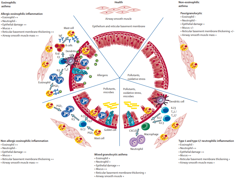 Asthma Targeted Therapy