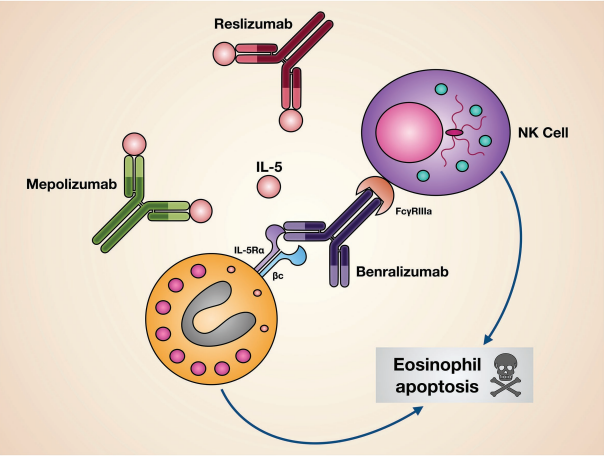 Asthma Targeted Therapy