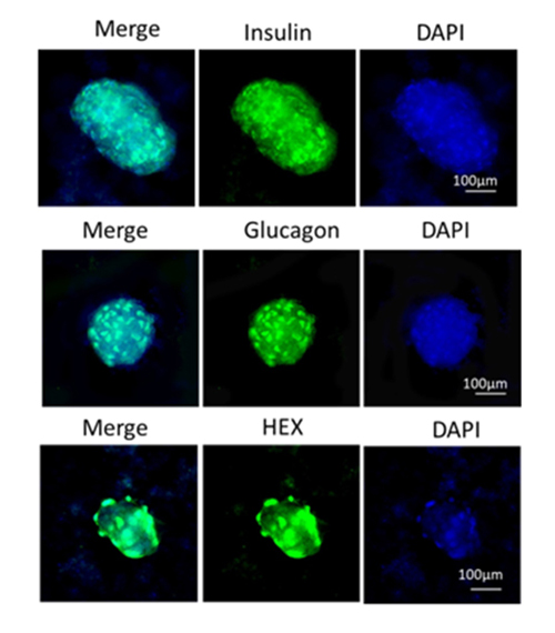 iPSC-Derived Islet Differentiation for Diabetes