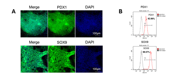 iPSC-Derived Islet Differentiation for Diabetes
