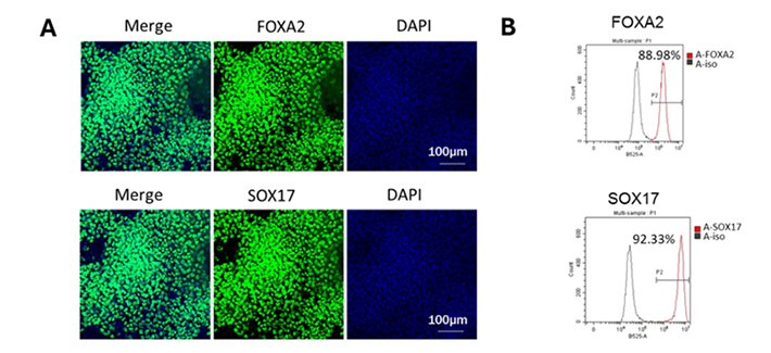 iPSC-Derived Islet Differentiation for Diabetes