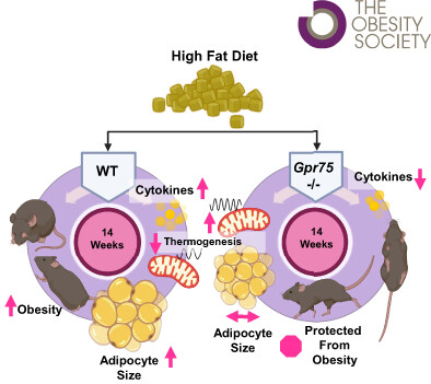 Advancing Obesity Therapeutics