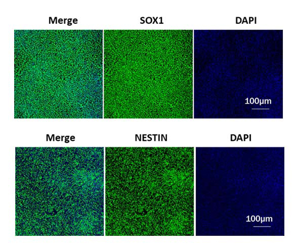 Accelerate PSC Derived Neuron Differentiation with Universal Laminin 521/511 & Complementary Growth Factors