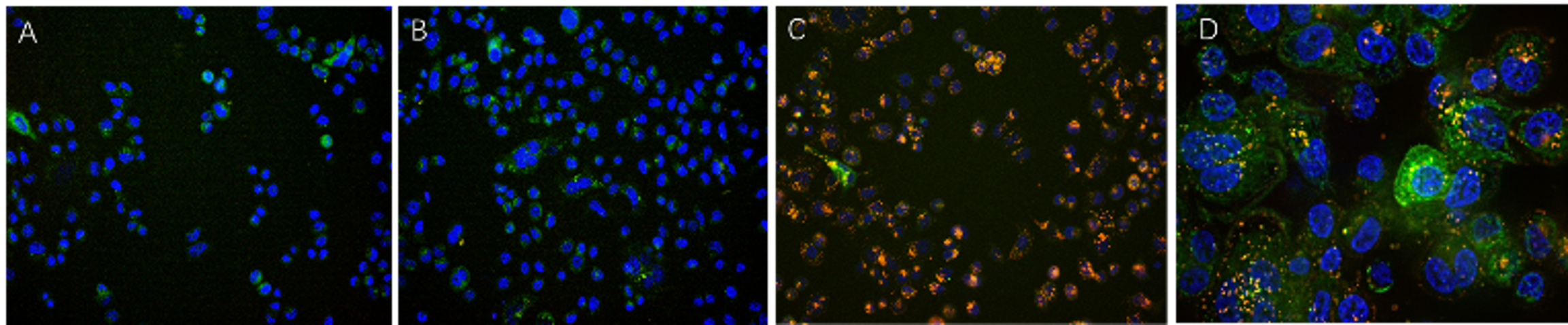 SK-BR-3 cells showing anti-HER2 antibody internalization with lysosome GFP colocalization and nuclear staining fluorescence imaging