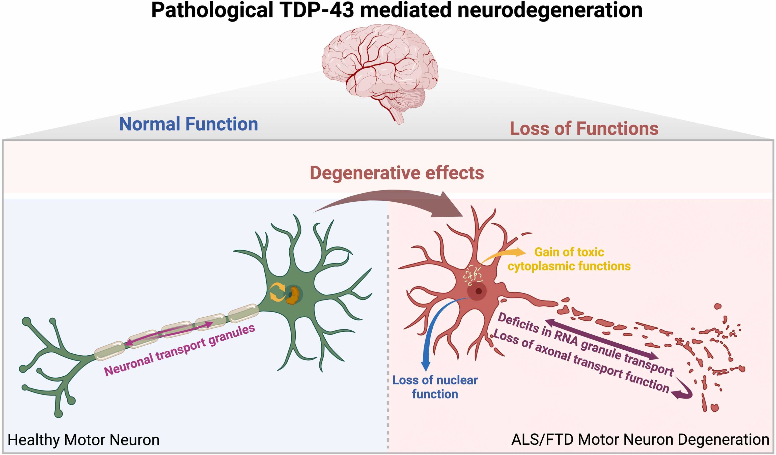TDP-43 pathology contributes to motor neuron dysfunction and degeneration