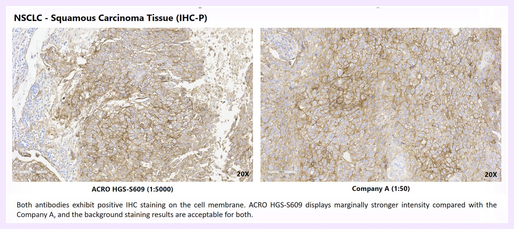 Comparative Multi-Tissue IHC Staining of HGS-S609 - 1