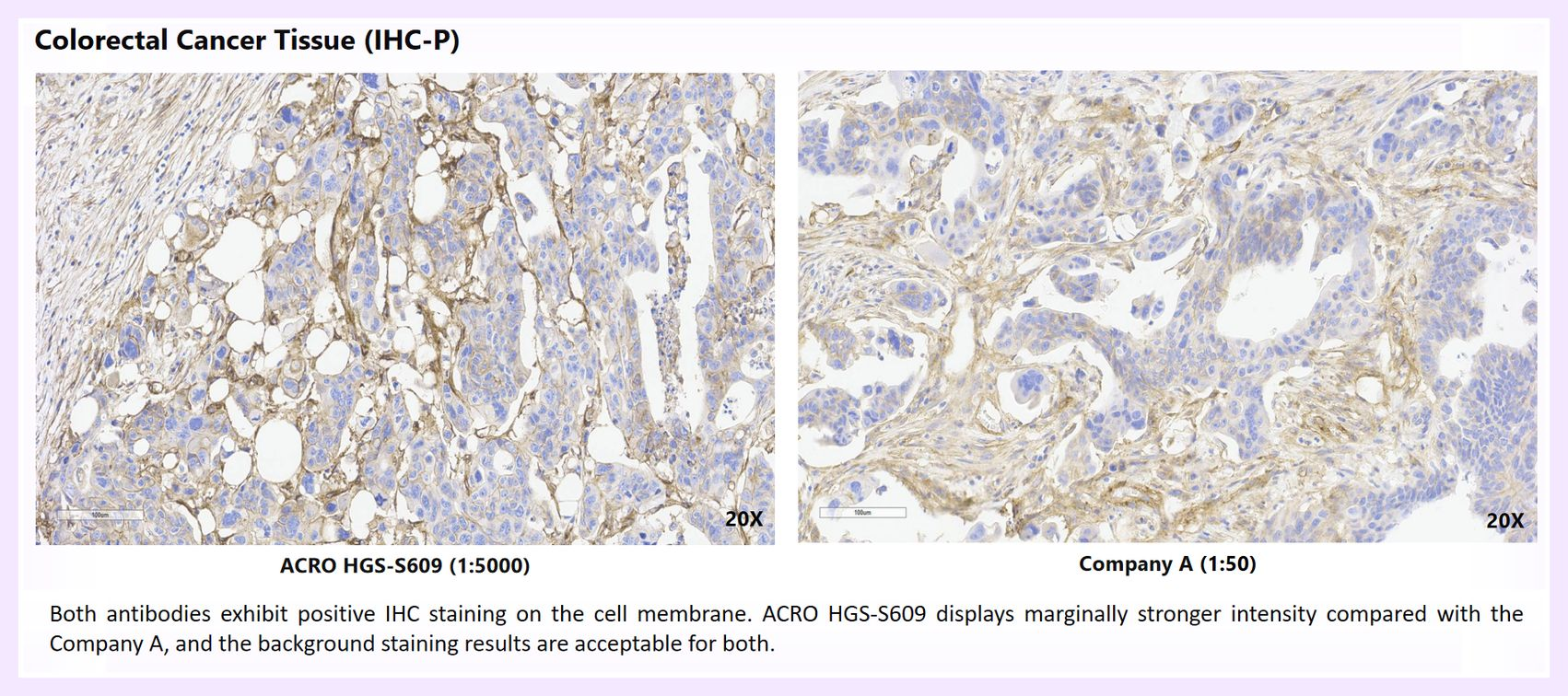Comparative Multi-Tissue IHC Staining of HGS-S609 - 2