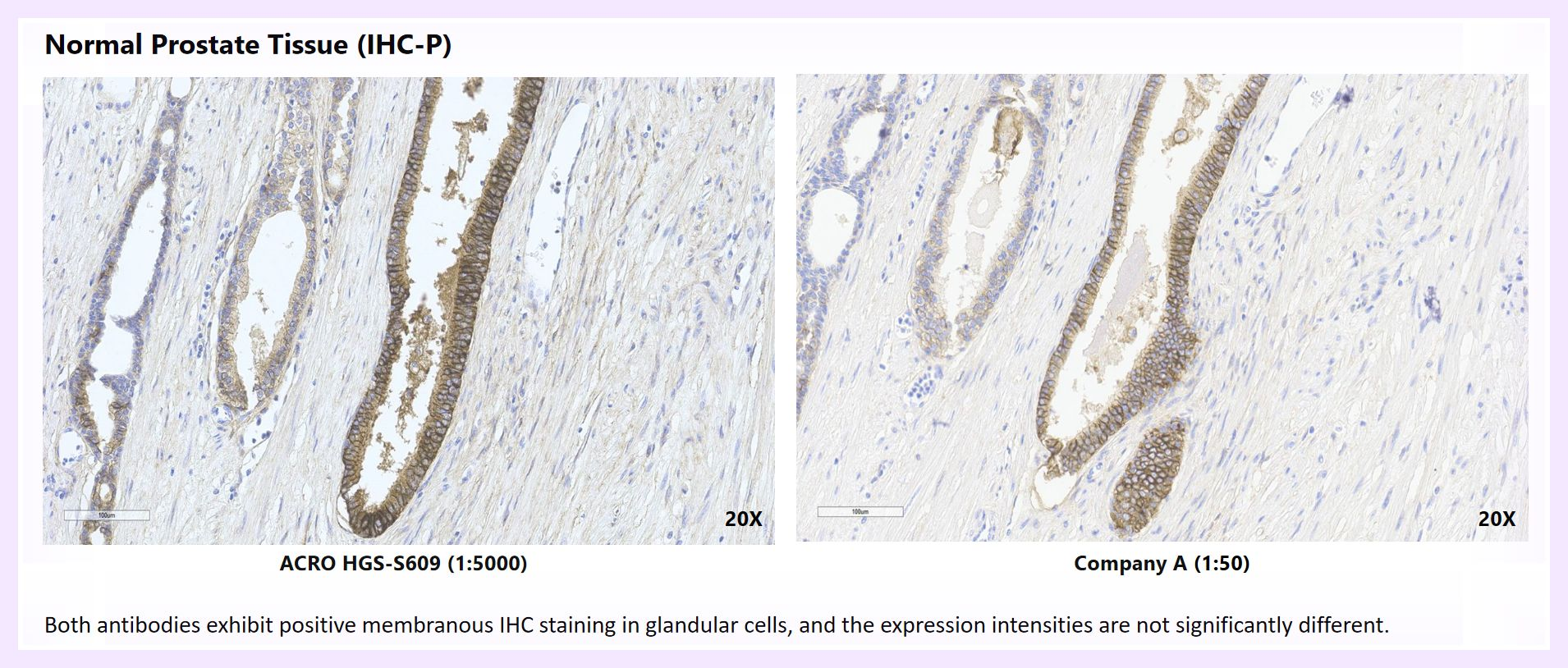 Comparative Multi-Tissue IHC Staining of HGS-S609 - 4