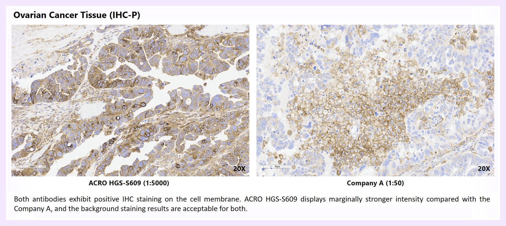 Comparative Multi-Tissue IHC Staining of HGS-S609 - 3
